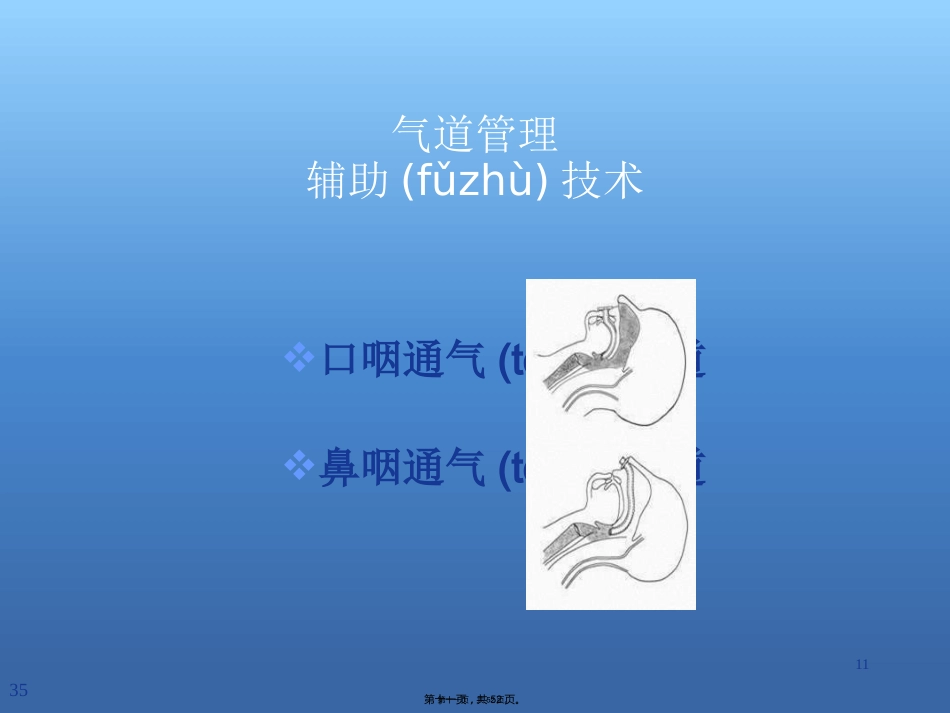 创伤急救的评估及处理_第11页