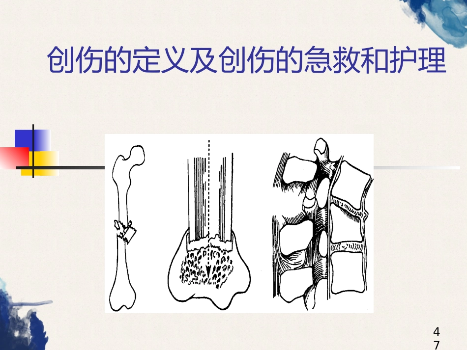 创伤的定义及创伤的急救和护理_第1页