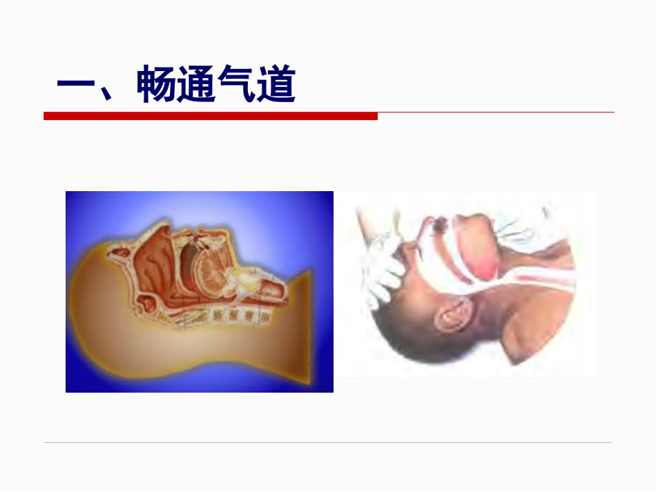 创伤急救五大 技术_第2页