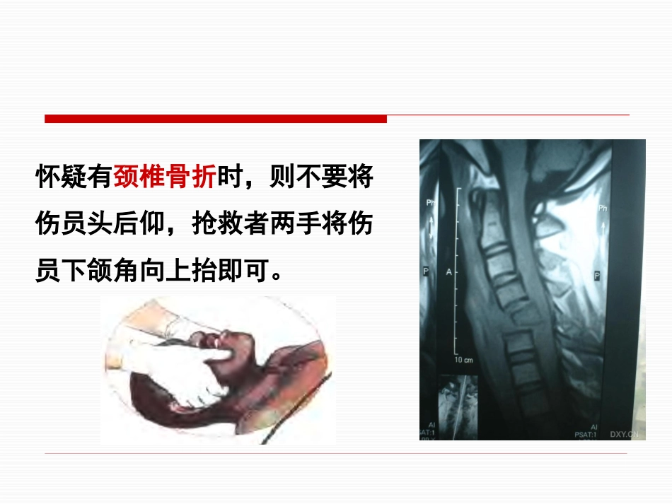 创伤急救五大 技术_第5页