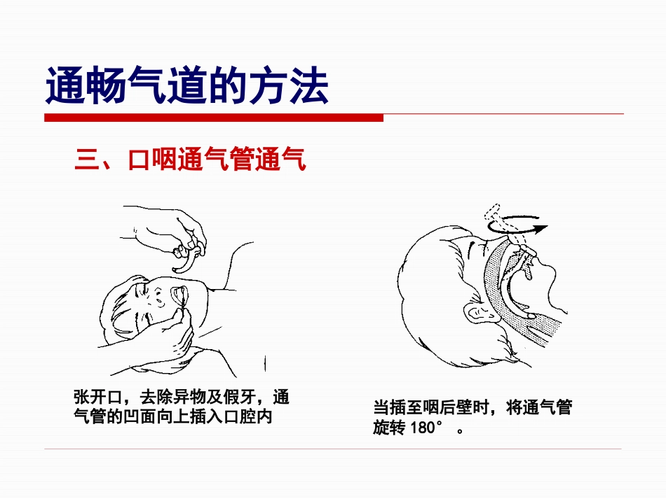 创伤急救五大 技术_第8页