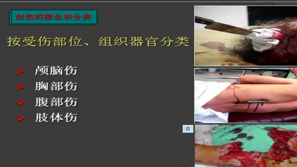 创伤的急救护理(急诊科) PPT_第5页