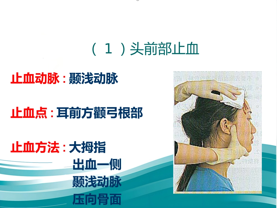 创伤急救——止血、包扎标准版PPT_第9页