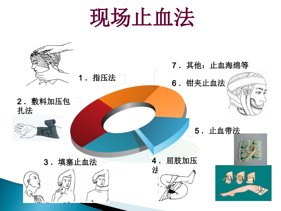 创伤急救止血包扎ppt课件_第13页