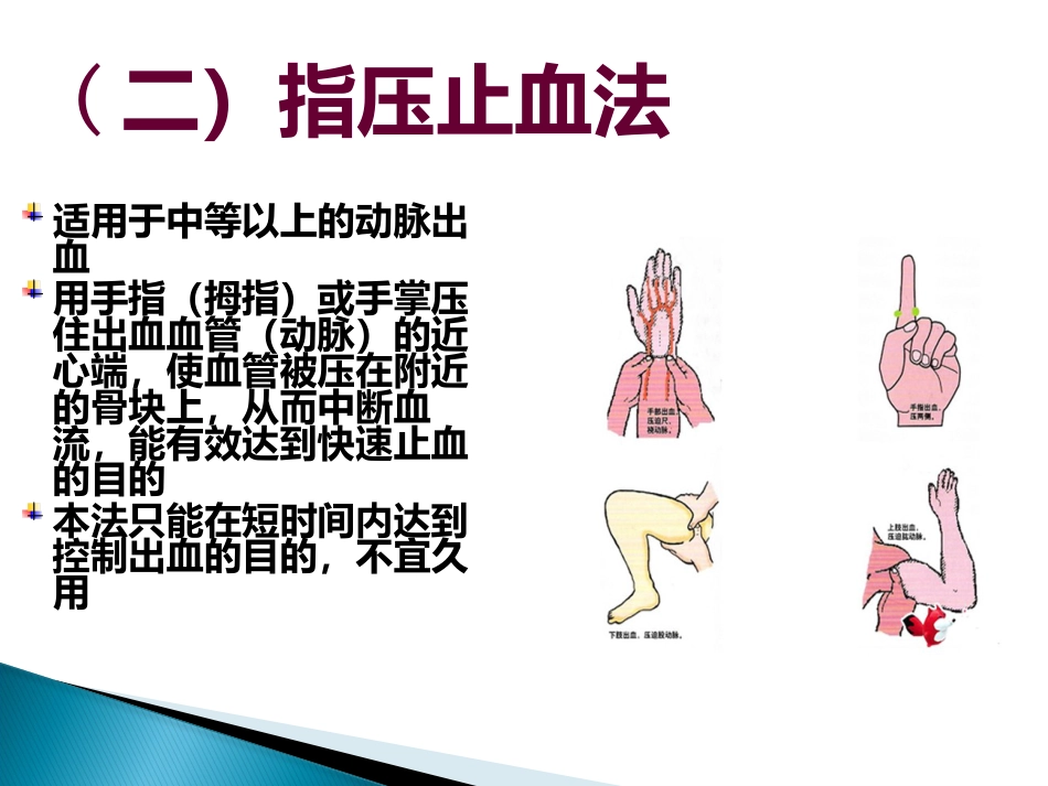 创伤急救止血包扎ppt课件_第15页