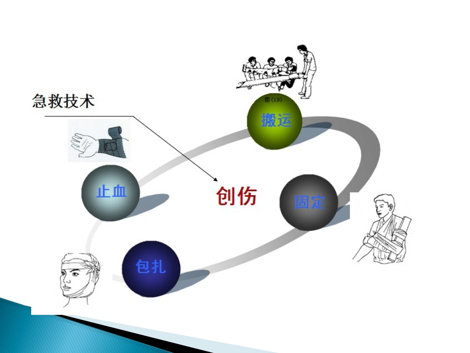 创伤急救止血包扎ppt课件_第9页