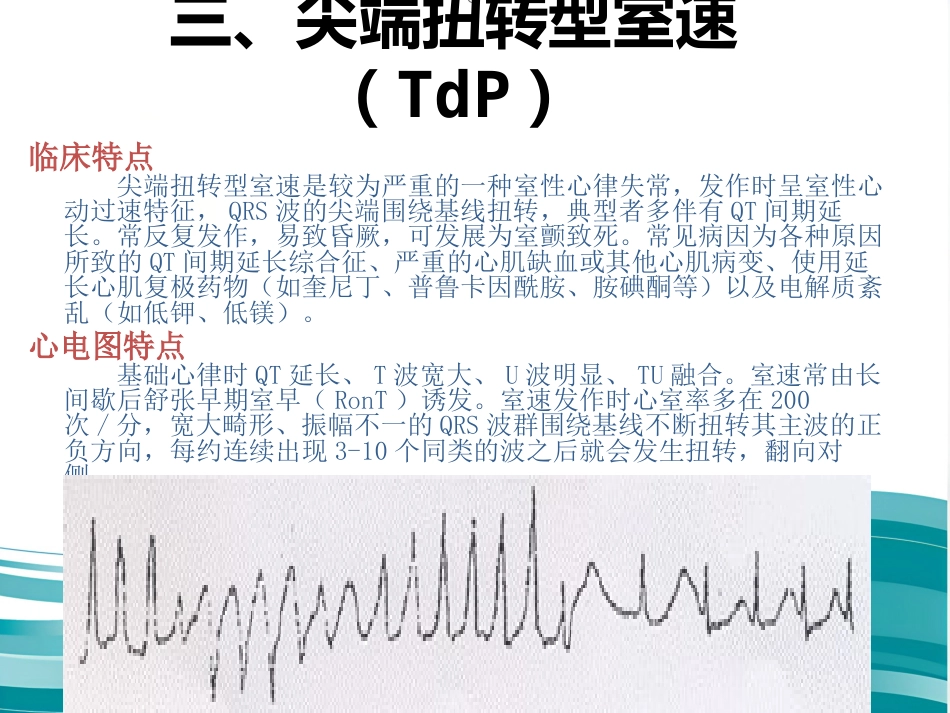 常见心律失常及急救护理课件_第14页