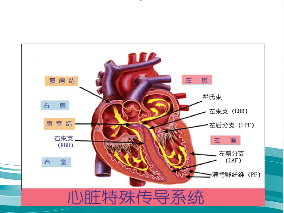 常见心律失常及急救护理课件_第2页