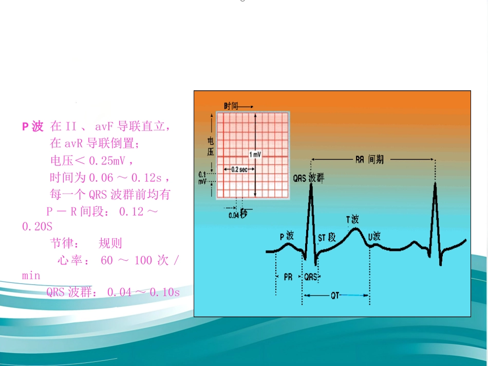 常见心律失常及急救护理课件_第4页