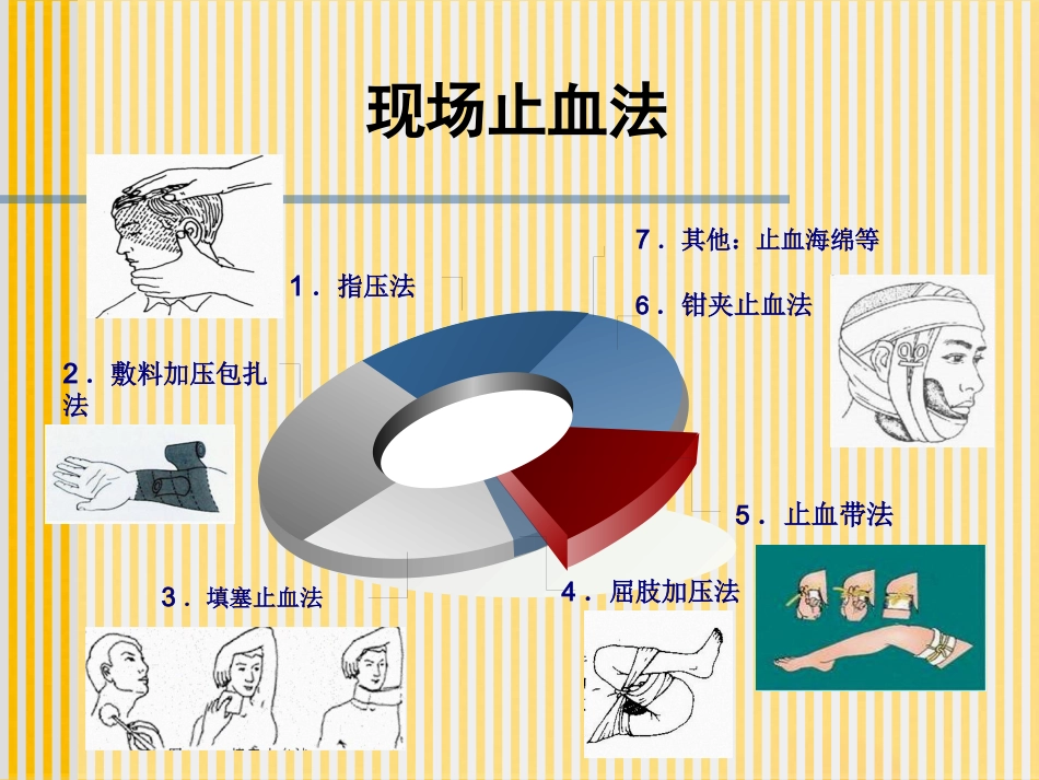 创伤基本急救技术止血篇_第11页