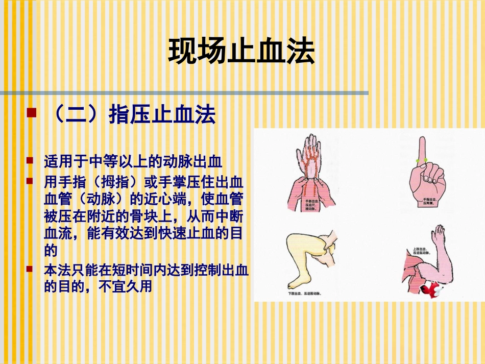 创伤基本急救技术止血篇_第13页