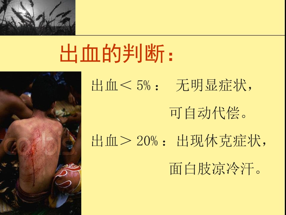 创伤现场急救_第10页