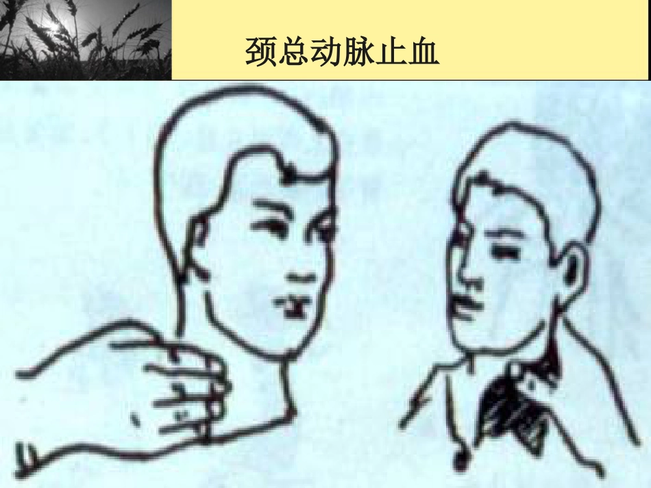 创伤现场急救_第14页
