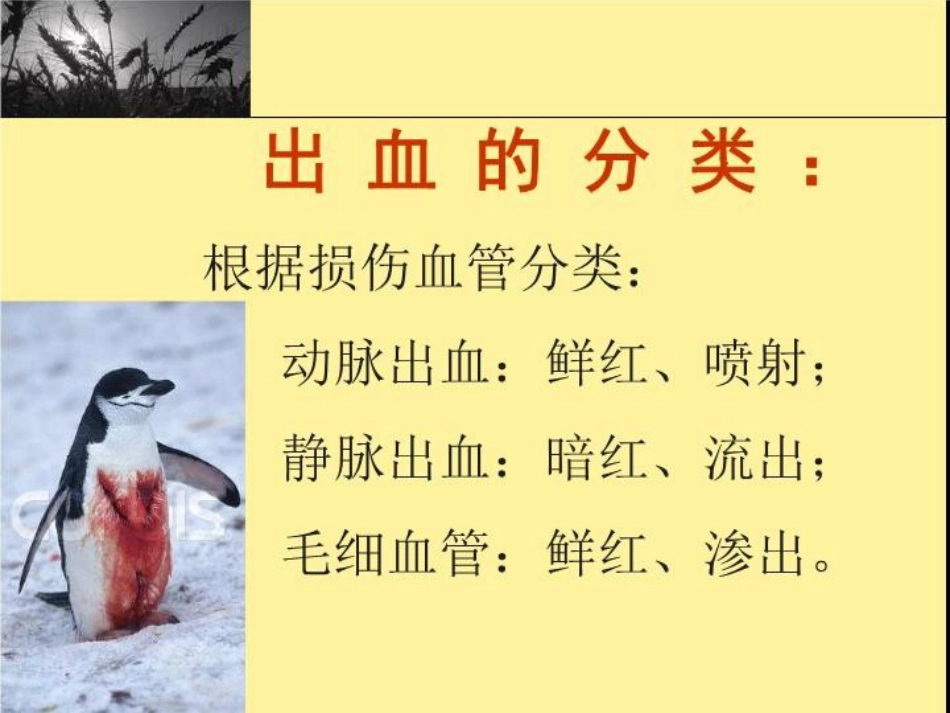 创伤现场急救_第8页