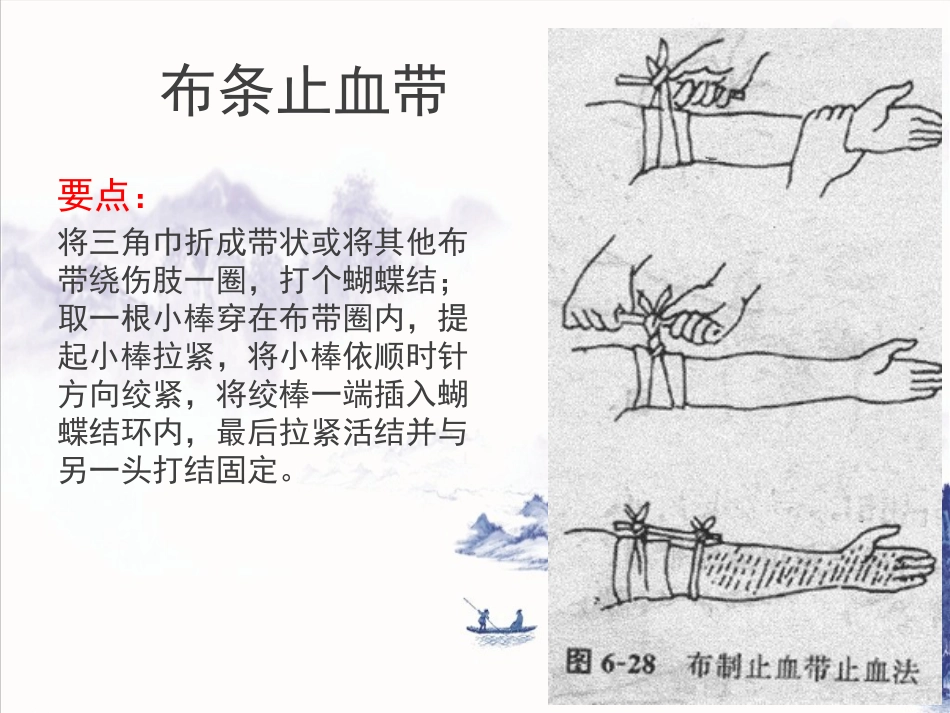 创伤急救(止血包扎固定)_第14页