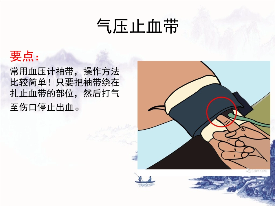 创伤急救(止血包扎固定)_第15页