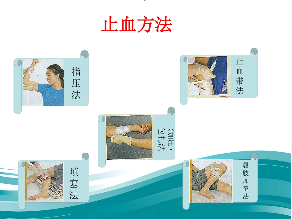 创伤骨折院前急救_第14页