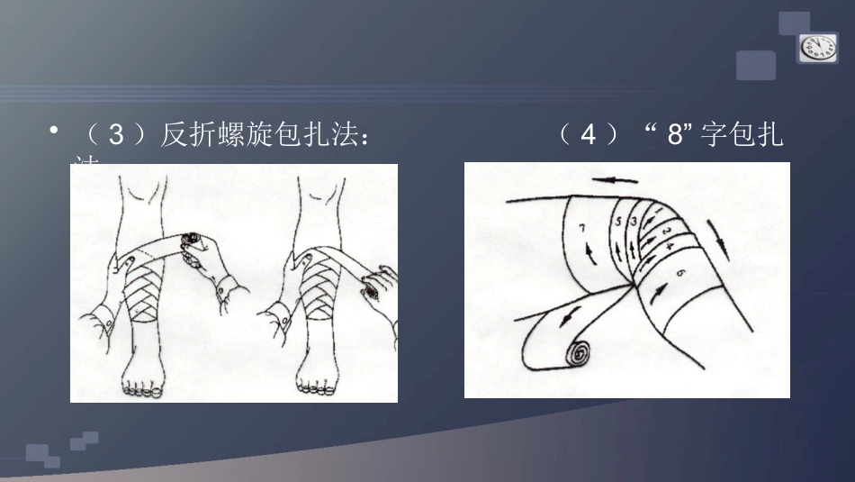 创伤急救包扎术_第7页