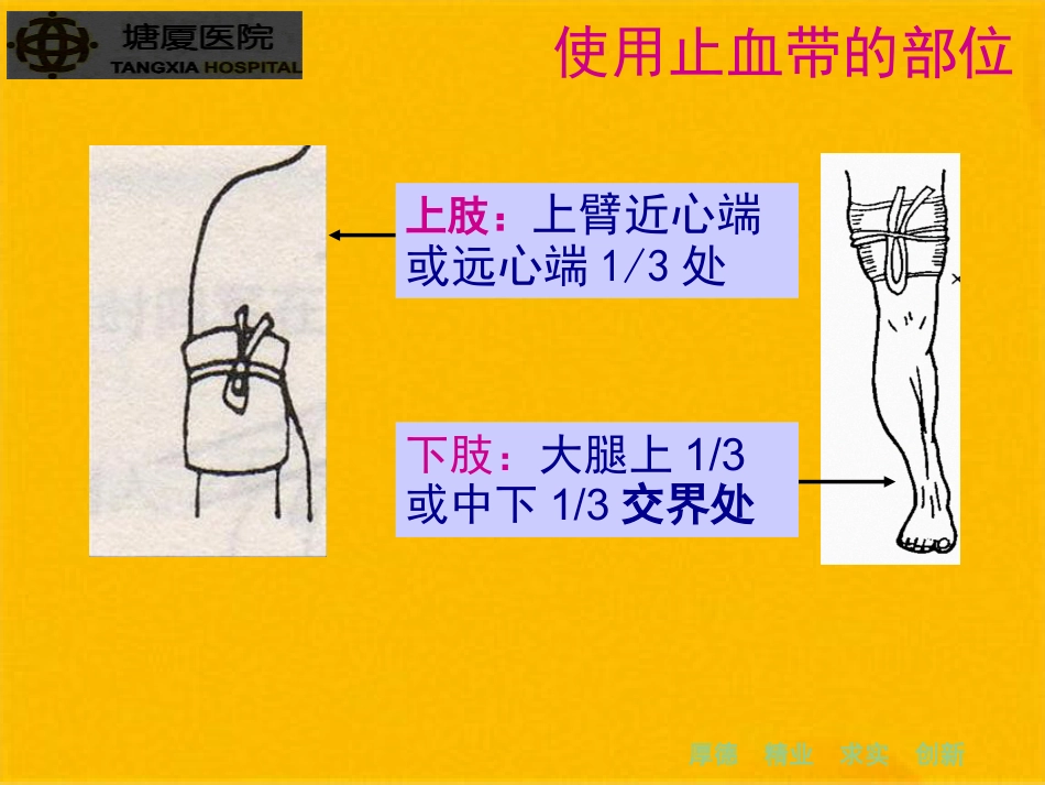 创伤急救技止血包扎固_第13页