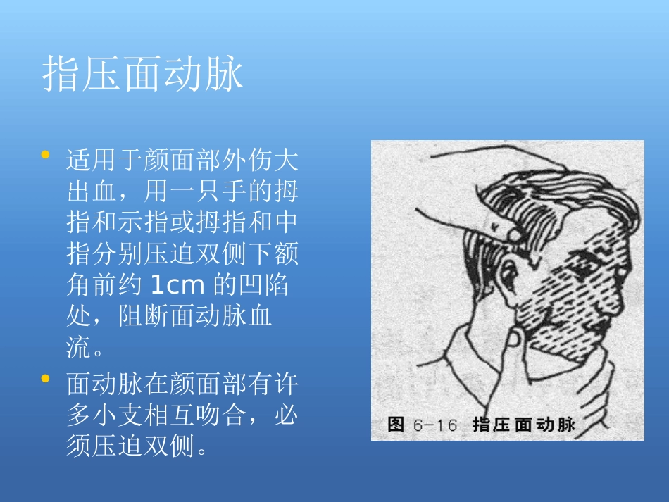 创伤急救处理ppt课件_第10页