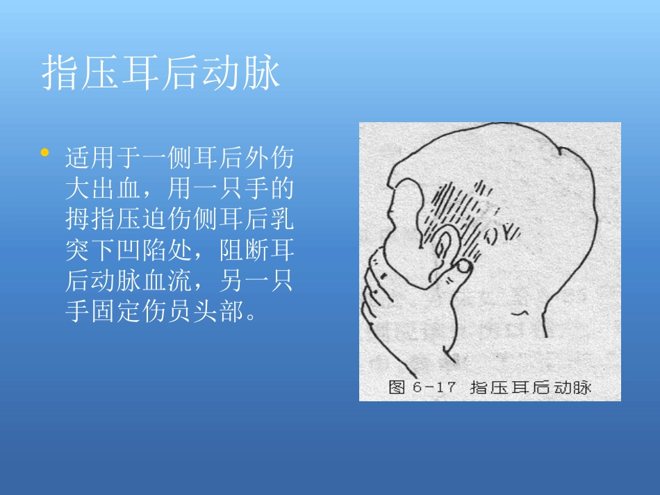 创伤急救处理ppt课件_第11页