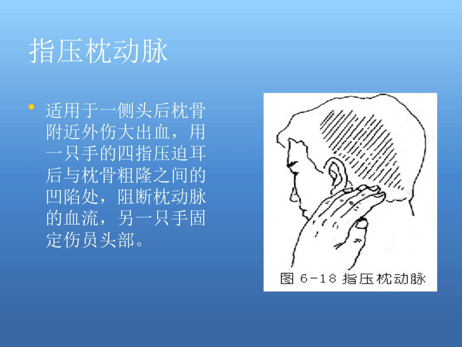 创伤急救处理ppt课件_第12页