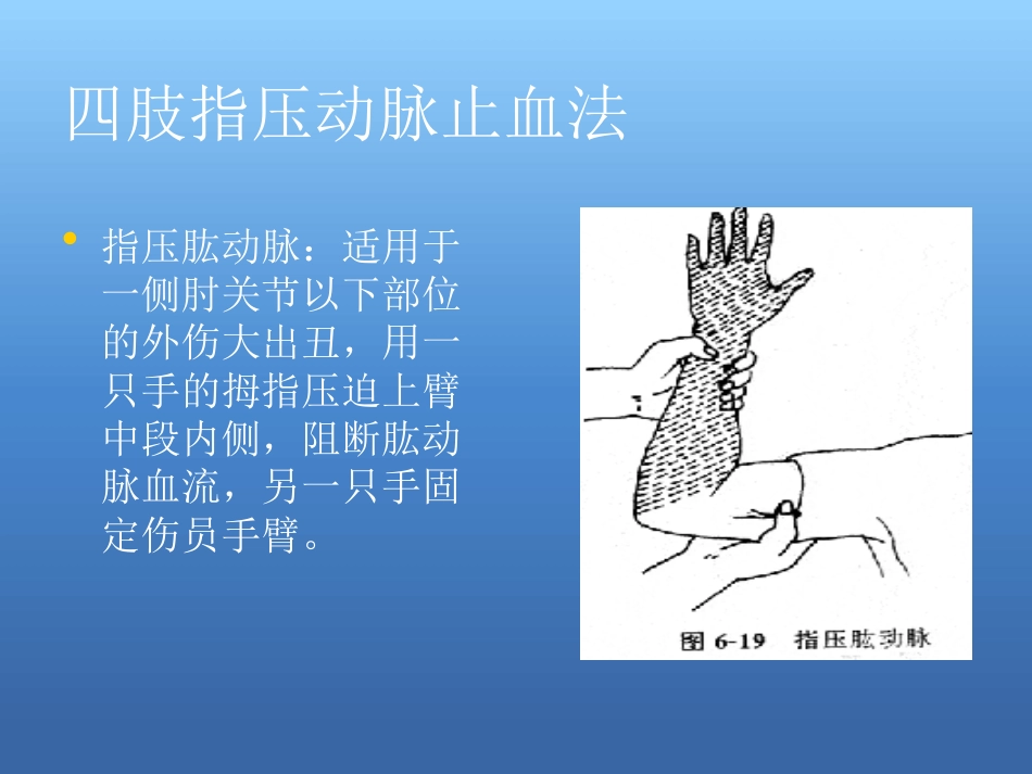 创伤急救处理ppt课件_第13页