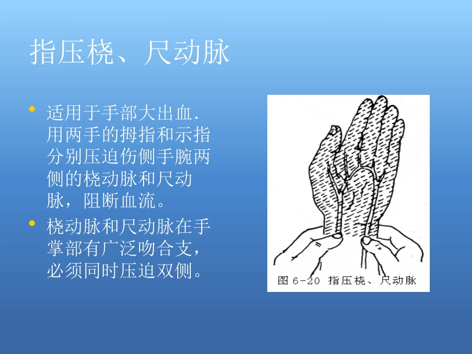 创伤急救处理ppt课件_第14页