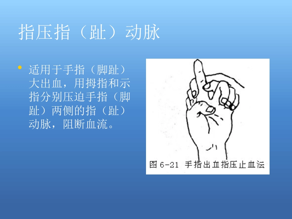 创伤急救处理ppt课件_第15页