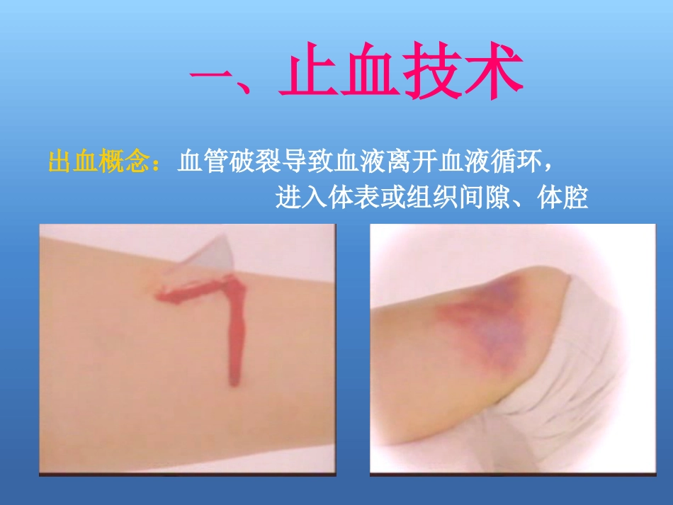 创伤急救处理ppt课件_第3页