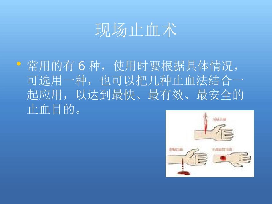 创伤急救处理ppt课件_第6页