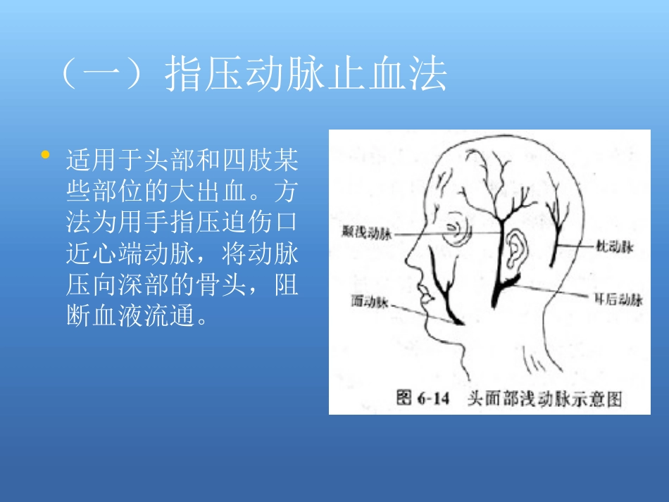 创伤急救处理ppt课件_第8页