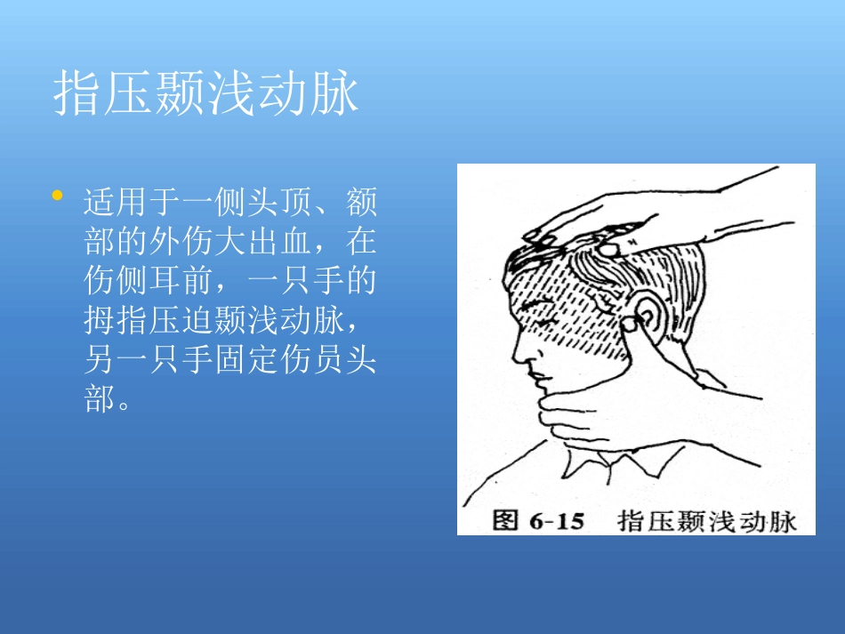 创伤急救处理ppt课件_第9页
