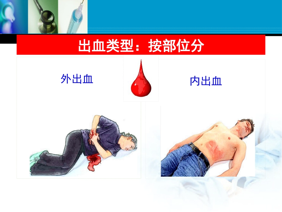 创伤急救之止血_第10页