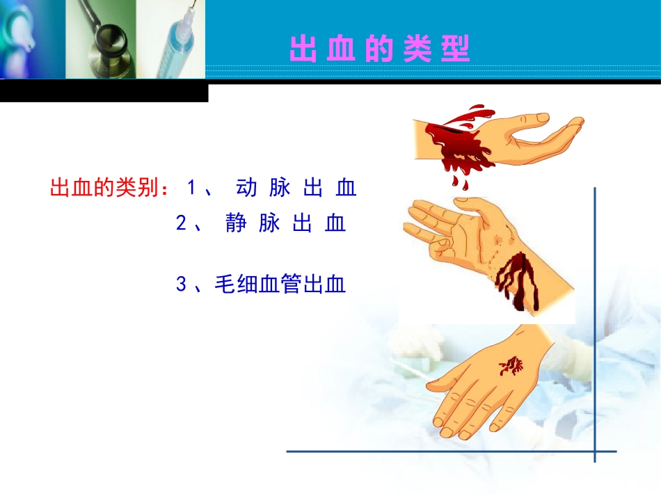 创伤急救之止血_第11页