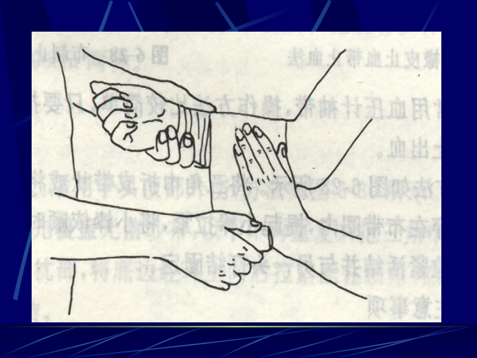 创伤急救(1)_第15页