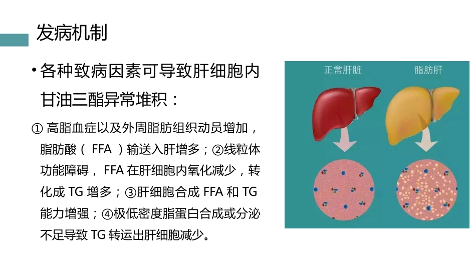 非酒精性肝病的中西医治疗_第12页
