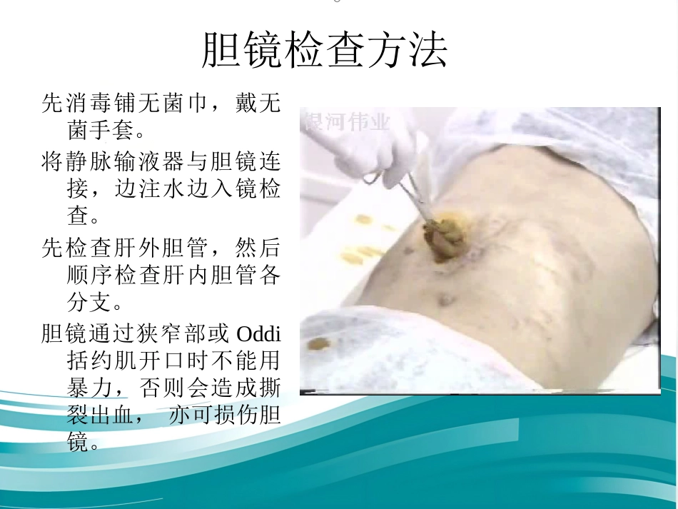胆道镜的使用_第12页