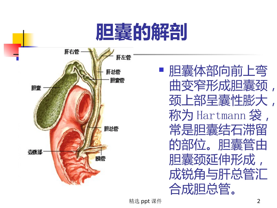 胆囊炎课件_第2页
