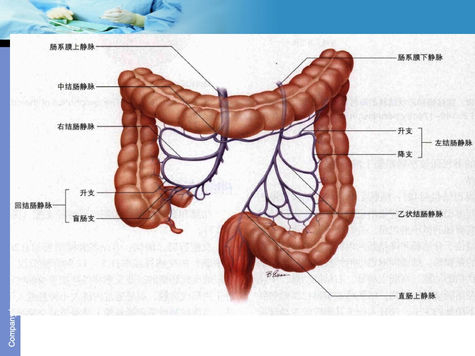 《结肠癌》ppt课件_第10页