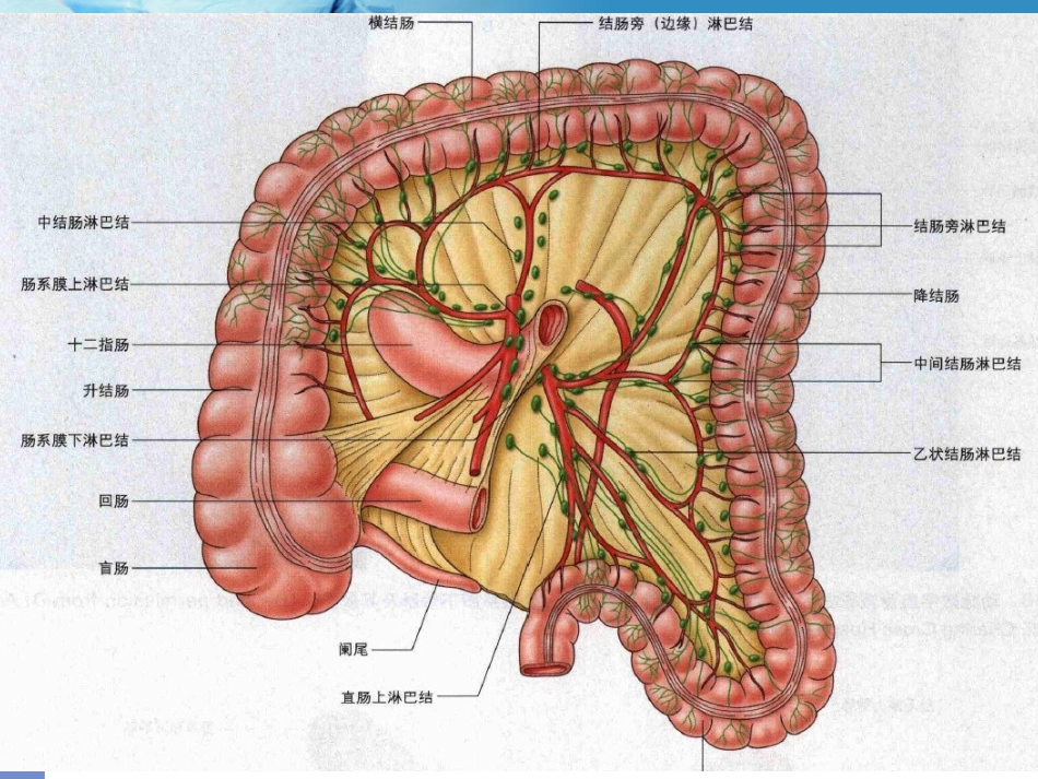 《结肠癌》ppt课件_第12页