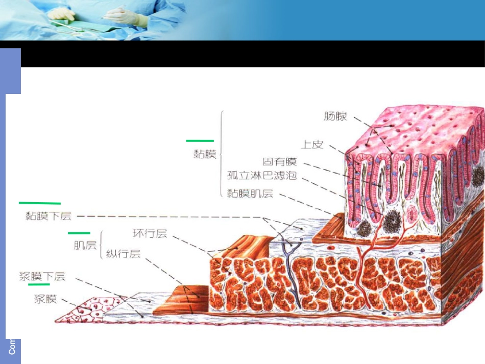 《结肠癌》ppt课件_第7页