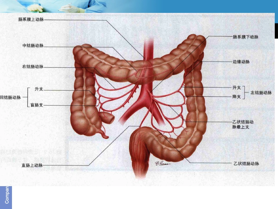 《结肠癌》ppt课件_第9页