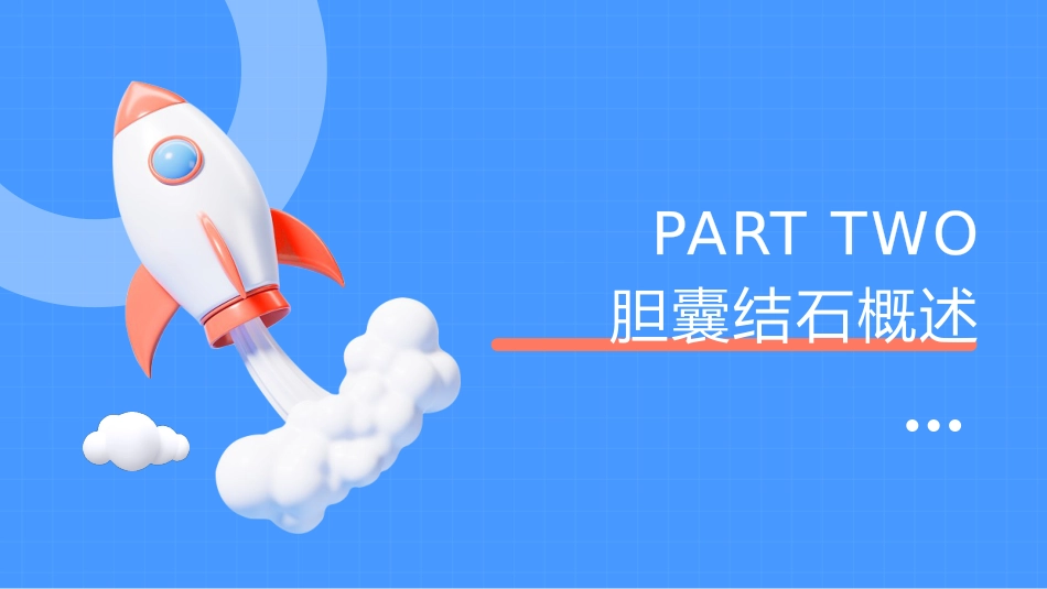 胆囊结石诊断与治疗PPT_第4页
