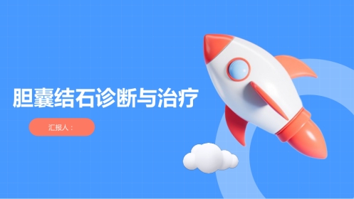 胆囊结石诊断与治疗PPT