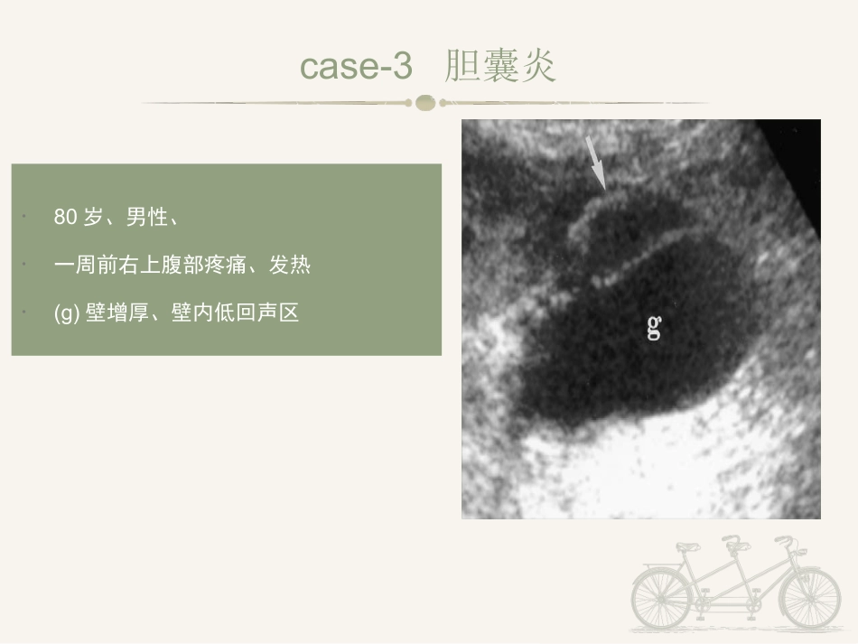 胆囊炎ppt_第4页