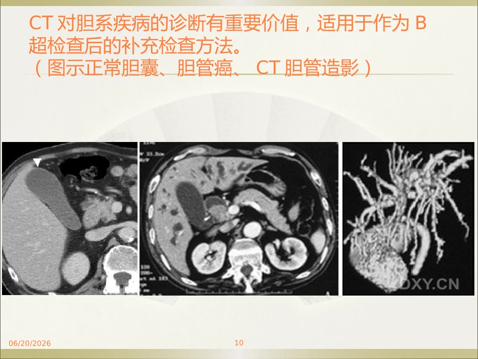 胆系疾病ppt课件_第10页
