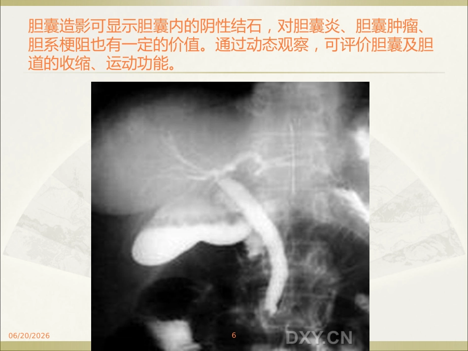 胆系疾病ppt课件_第6页