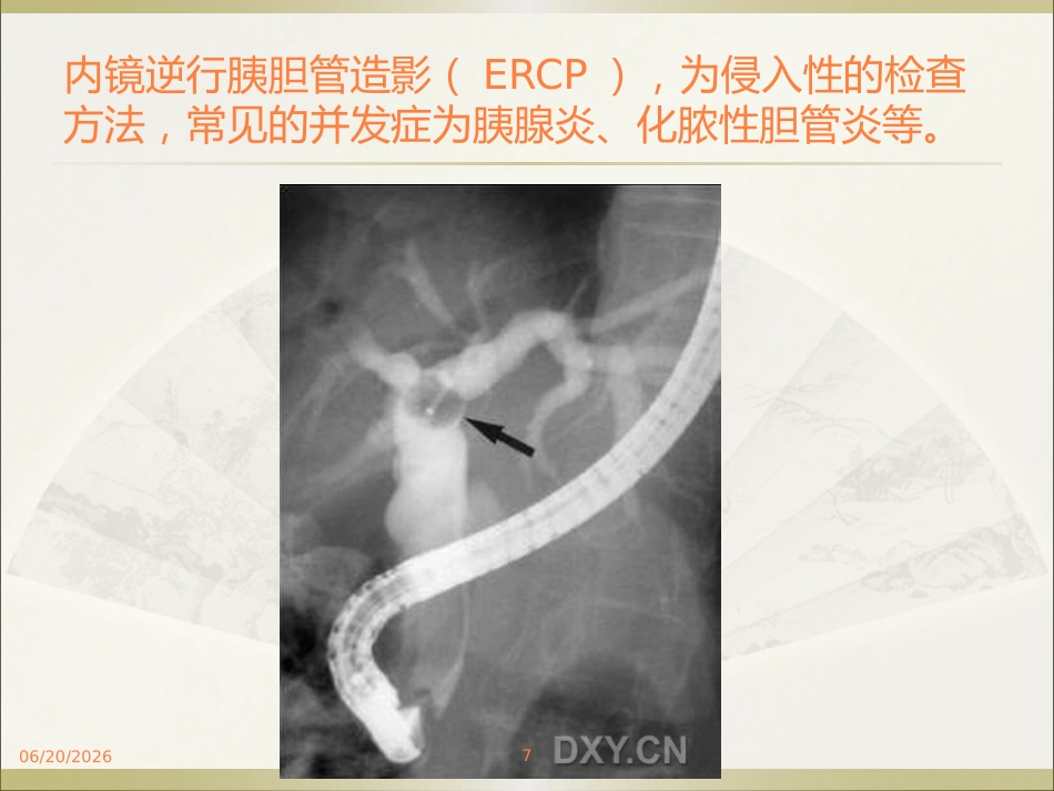 胆系疾病ppt课件_第7页