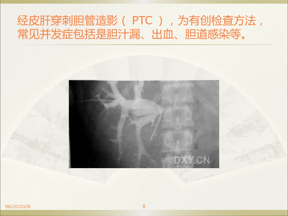 胆系疾病ppt课件_第8页
